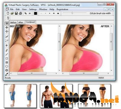 Virtual Plastic Surgery 1.2