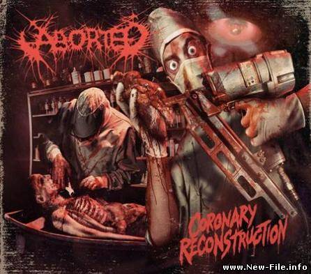 Aborted 2010 Coronary Reconstruction